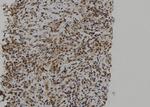 PTPN23 Antibody in Immunohistochemistry (Paraffin) (IHC (P))