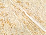 PTPN23 Antibody in Immunohistochemistry (Paraffin) (IHC (P))