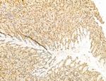 PTPN23 Antibody in Immunohistochemistry (Paraffin) (IHC (P))