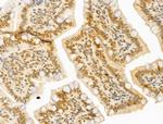 PTPN23 Antibody in Immunohistochemistry (Paraffin) (IHC (P))