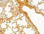 PTPN23 Antibody in Immunohistochemistry (Paraffin) (IHC (P))