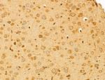 PTPN23 Antibody in Immunohistochemistry (Paraffin) (IHC (P))