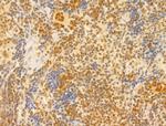 PTPN23 Antibody in Immunohistochemistry (Paraffin) (IHC (P))