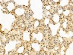 PTPN23 Antibody in Immunohistochemistry (Paraffin) (IHC (P))