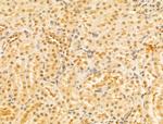 PTPN23 Antibody in Immunohistochemistry (Paraffin) (IHC (P))