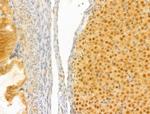 PTPN23 Antibody in Immunohistochemistry (Paraffin) (IHC (P))