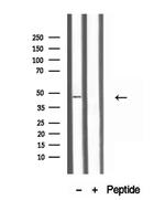 TTLL6 Antibody in Western Blot (WB)