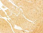 YTHDF2 Antibody in Immunohistochemistry (Paraffin) (IHC (P))