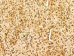 YTHDF2 Antibody in Immunohistochemistry (Paraffin) (IHC (P))