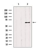 YTHDF2 Antibody in Western Blot (WB)