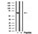 YTHDF2 Antibody in Western Blot (WB)