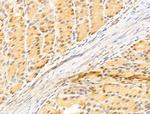 ZCCHC11 Antibody in Immunohistochemistry (Paraffin) (IHC (P))