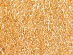 ACADS Antibody in Immunohistochemistry (Paraffin) (IHC (P))