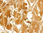 ACADS Antibody in Immunohistochemistry (Paraffin) (IHC (P))