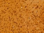 BCS1L Antibody in Immunohistochemistry (Paraffin) (IHC (P))