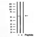 BCS1L Antibody in Western Blot (WB)