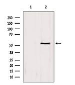 BCS1L Antibody in Western Blot (WB)