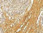 COL6A1 Antibody in Immunohistochemistry (Paraffin) (IHC (P))