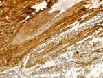 COL6A1 Antibody in Immunohistochemistry (Paraffin) (IHC (P))