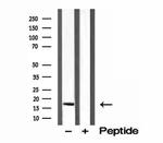 CPLX1 Antibody in Western Blot (WB)