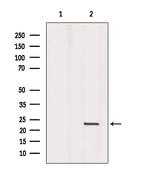 DPT Antibody in Western Blot (WB)