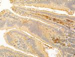 ERO1LB Antibody in Immunohistochemistry (Paraffin) (IHC (P))