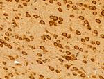 HLA-F Antibody in Immunohistochemistry (Paraffin) (IHC (P))