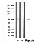 IFT52 Antibody in Western Blot (WB)