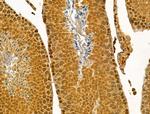 Importin 4 Antibody in Immunohistochemistry (Paraffin) (IHC (P))