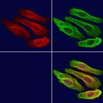 Importin 4 Antibody in Immunocytochemistry (ICC/IF)