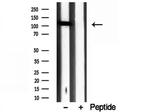 Importin 4 Antibody in Western Blot (WB)