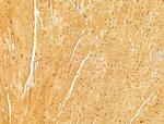 MAVS Antibody in Immunohistochemistry (Paraffin) (IHC (P))