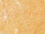 NAPRT1 Antibody in Immunohistochemistry (Paraffin) (IHC (P))