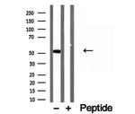 NAPRT1 Antibody in Western Blot (WB)