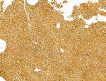 PKLR Antibody in Immunohistochemistry (Paraffin) (IHC (P))