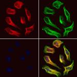 SEPT9 Antibody in Immunocytochemistry (ICC/IF)