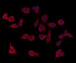 SEPT9 Antibody in Immunocytochemistry (ICC/IF)