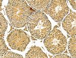 SEPT9 Antibody in Immunohistochemistry (Paraffin) (IHC (P))