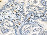 SEPT9 Antibody in Immunohistochemistry (Paraffin) (IHC (P))