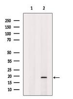 SNAPAP Antibody in Western Blot (WB)