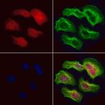 SRP68 Antibody in Immunocytochemistry (ICC/IF)