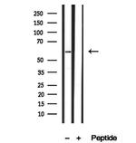 SRP68 Antibody in Western Blot (WB)