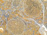 HRD1 Antibody in Immunohistochemistry (Paraffin) (IHC (P))