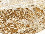 HRD1 Antibody in Immunohistochemistry (Paraffin) (IHC (P))