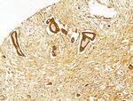 HRD1 Antibody in Immunohistochemistry (Paraffin) (IHC (P))