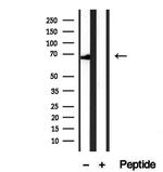 HRD1 Antibody in Western Blot (WB)