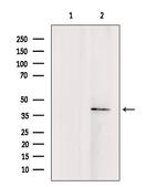 TMOD4 Antibody in Western Blot (WB)