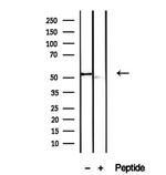 VNN1 Antibody in Western Blot (WB)