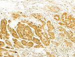 VPS37A Antibody in Immunohistochemistry (Paraffin) (IHC (P))