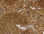 AEBP2 Antibody in Immunohistochemistry (Paraffin) (IHC (P))